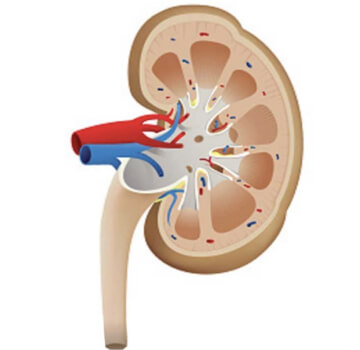 Ureterolitotricia neumática y láser