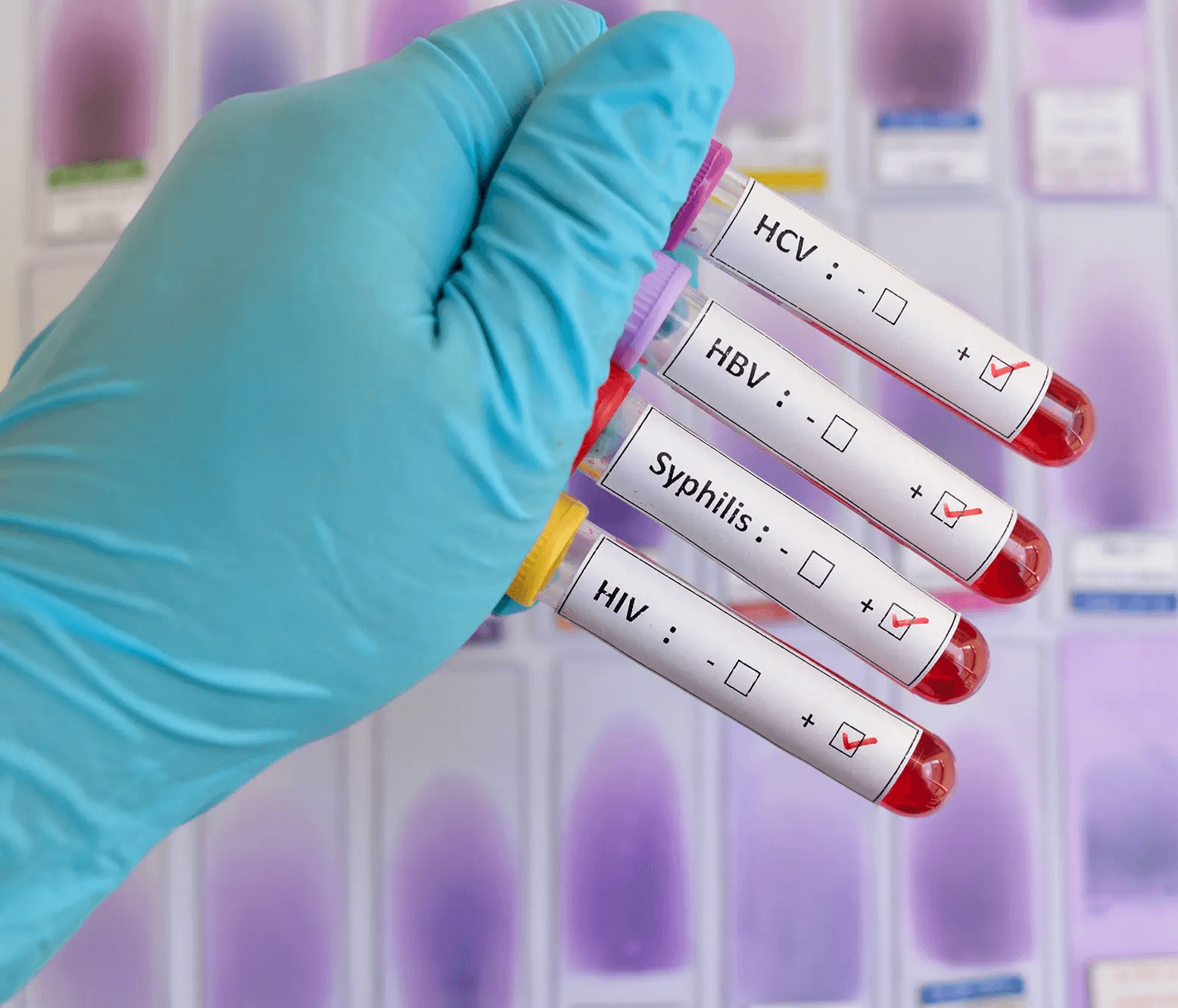 Clínica con especialidad en ETS